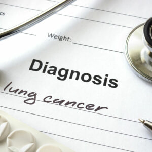 Lung Cancer – Types, Causes, and Symptoms
