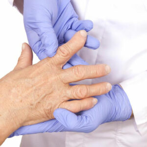 4 best remedies for rheumatoid arthritis