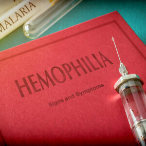 Hemophilia – 4 main symptoms and their severity